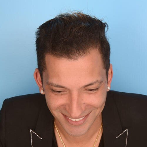 bauman-hair-40yr-man bauman-hair-40yr-man