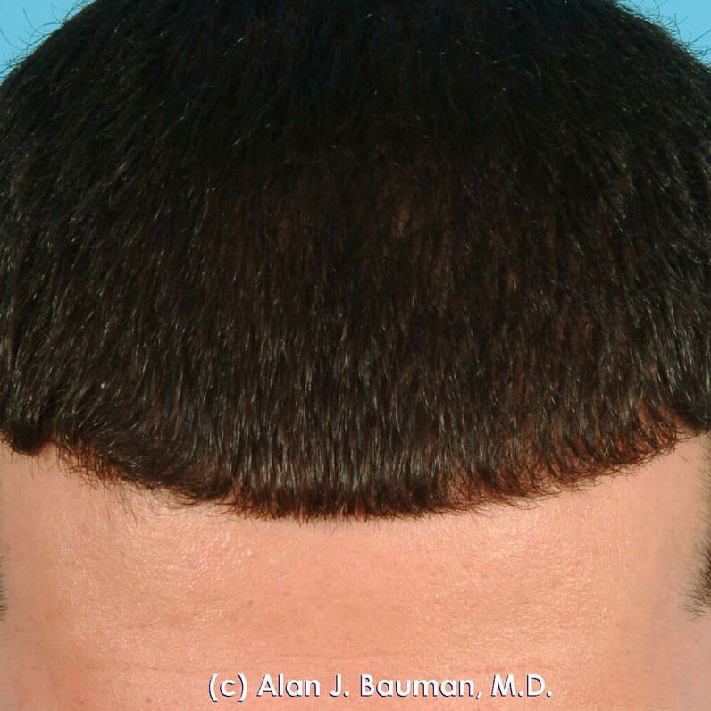 male-02-after male-02-after